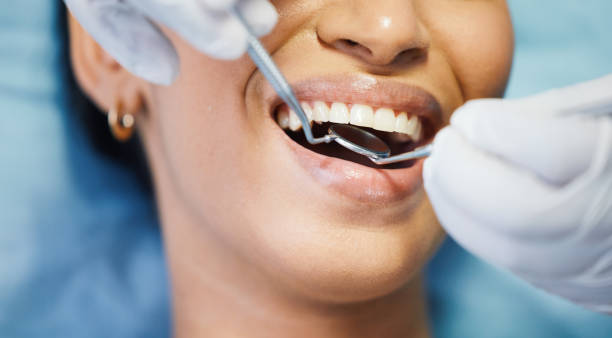 Best Emergency Tooth Extraction in Morton, TX