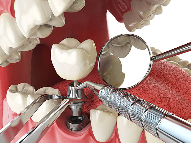 Best Walk-In Emergency Dentist in Morton, TX