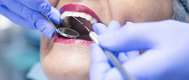 Best Emergency Wisdom Teeth Removal in Morton, TX